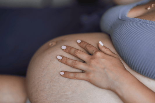 pregnancy stretch marks